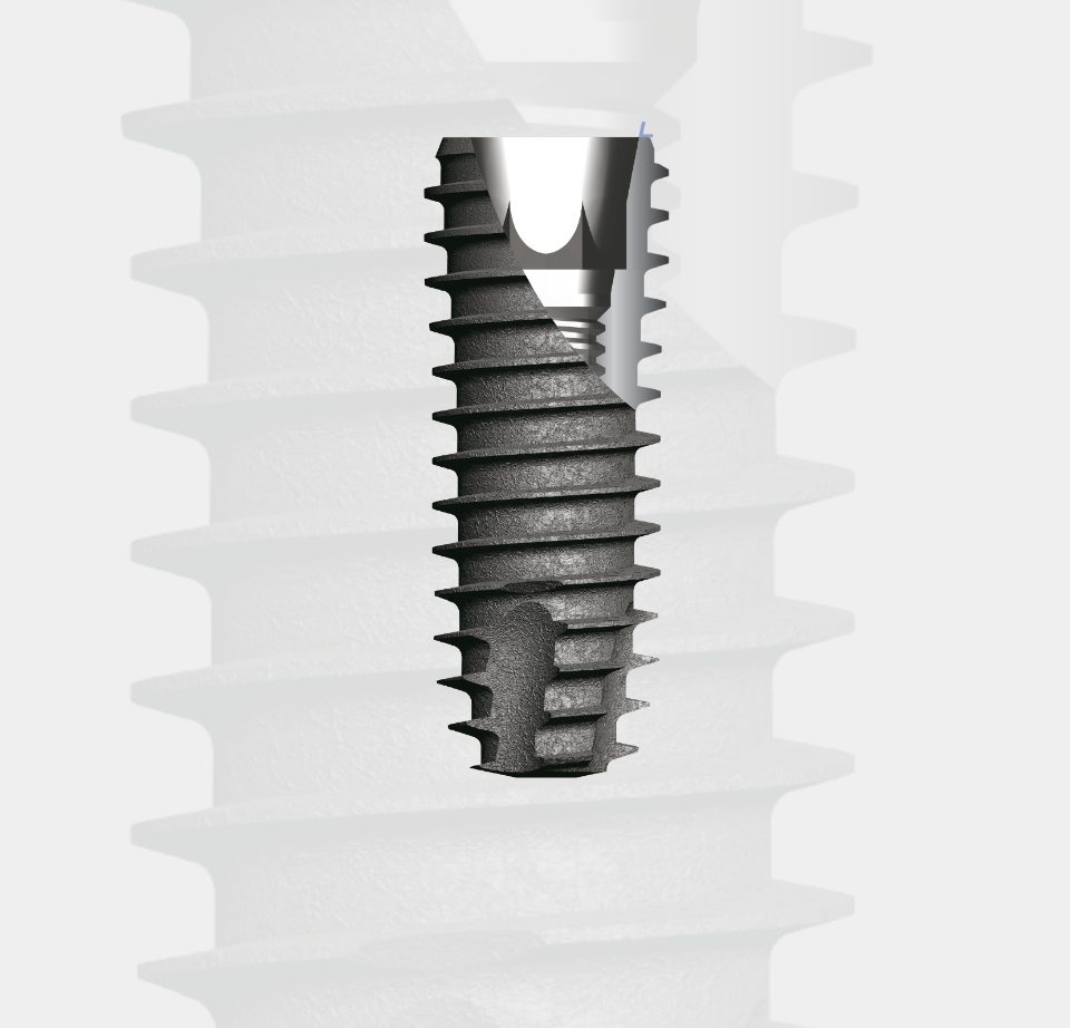 Vertex Line N